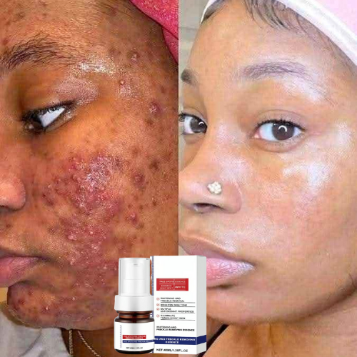 Vitamin C,un visage propre et sans tâche. ML/Bamako