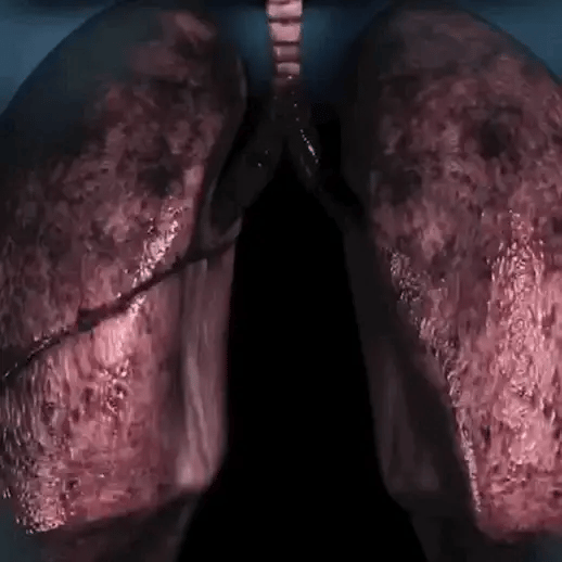 Entraîneur de respiration Oxy. TG